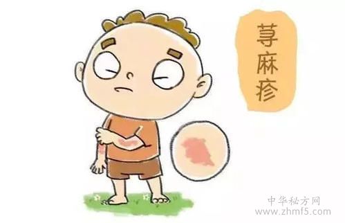 蕁麻疹反復(fù)發(fā)作怎么回事