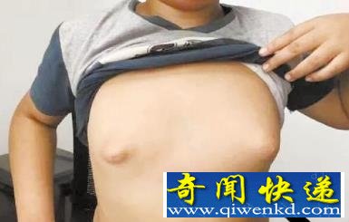 姐姐1個胸6斤重 姐弟乳房發(fā)育過大的元兇揭露