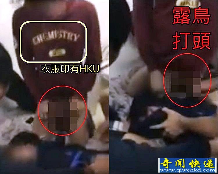 香港大學(xué)集體欺凌事件 一名男生下體被滴蠟