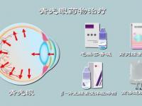 青光眼激光治療副作用_青光眼激光治療副作用大不大