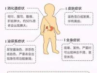 蠶豆病的癥狀,蠶豆病的癥狀有哪些