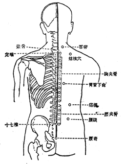 腰奇穴位位置圖-人體穴位查詢