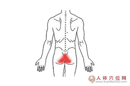 針刺配合貼敷治尾骨疼